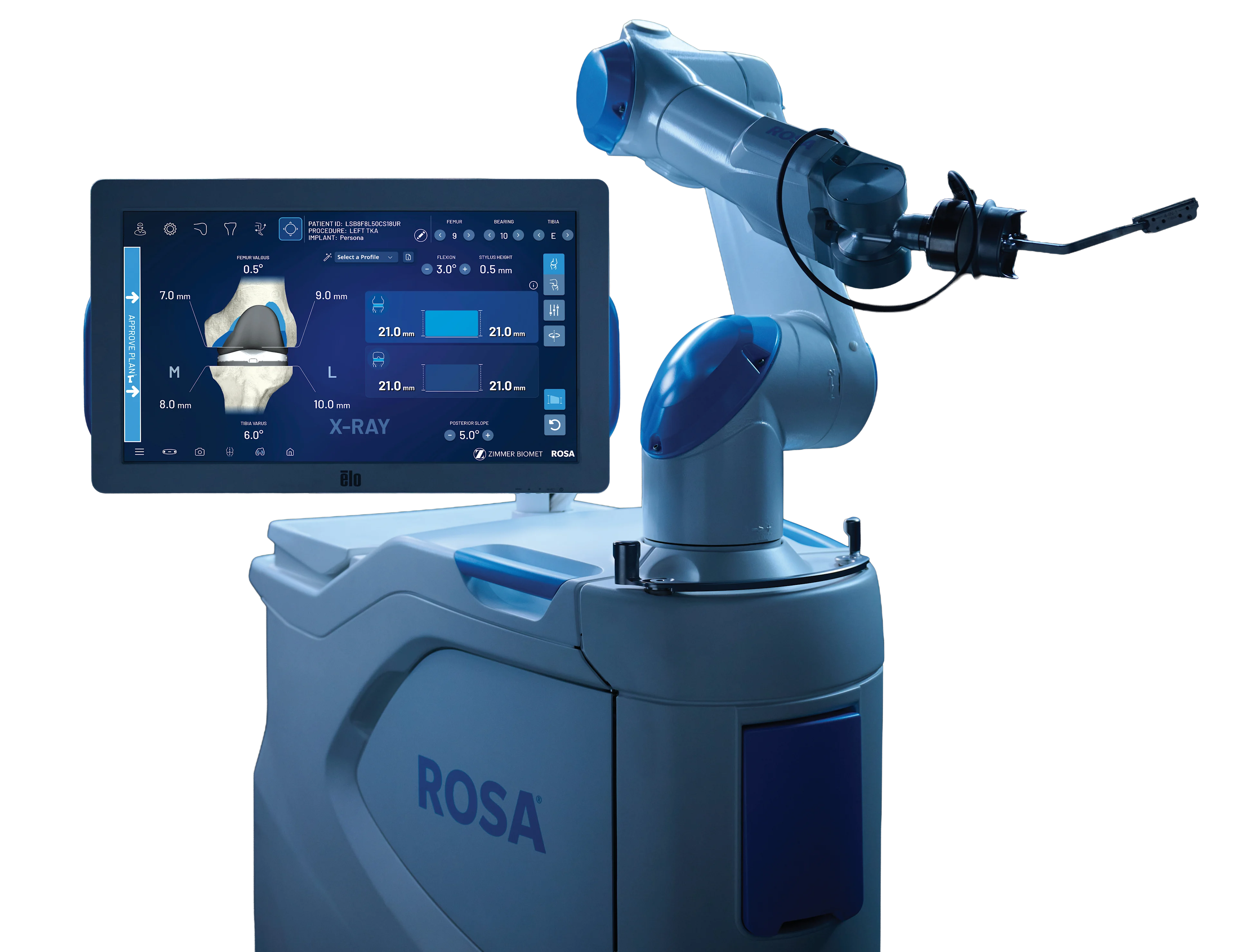 ROSA Knee System（含 OptimiZe）